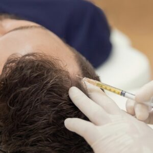 Estudia la maestría en mesoterapia capilar